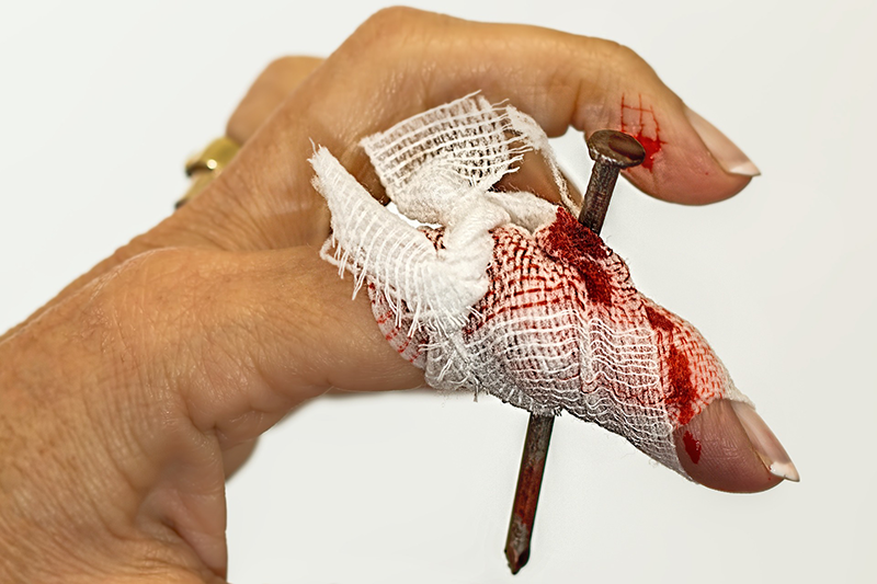 work accident